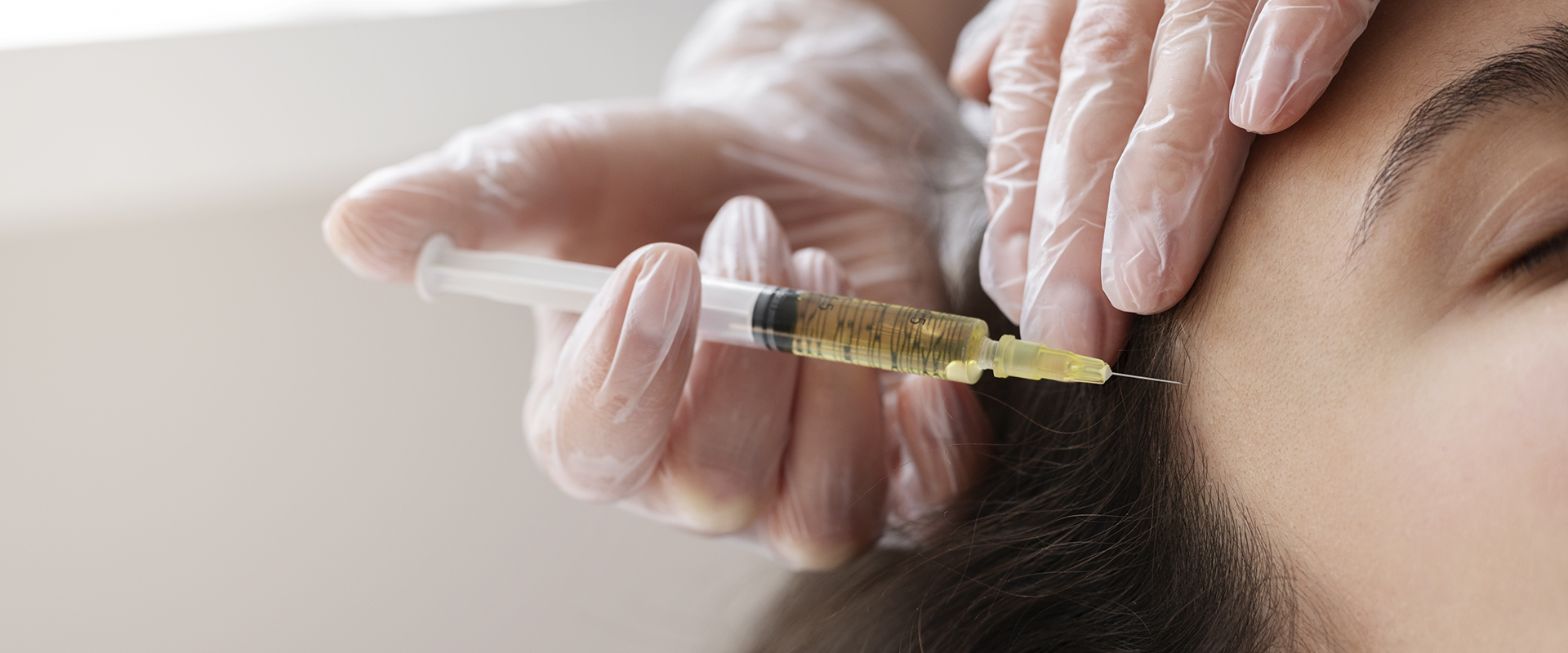 Derma Fillers 