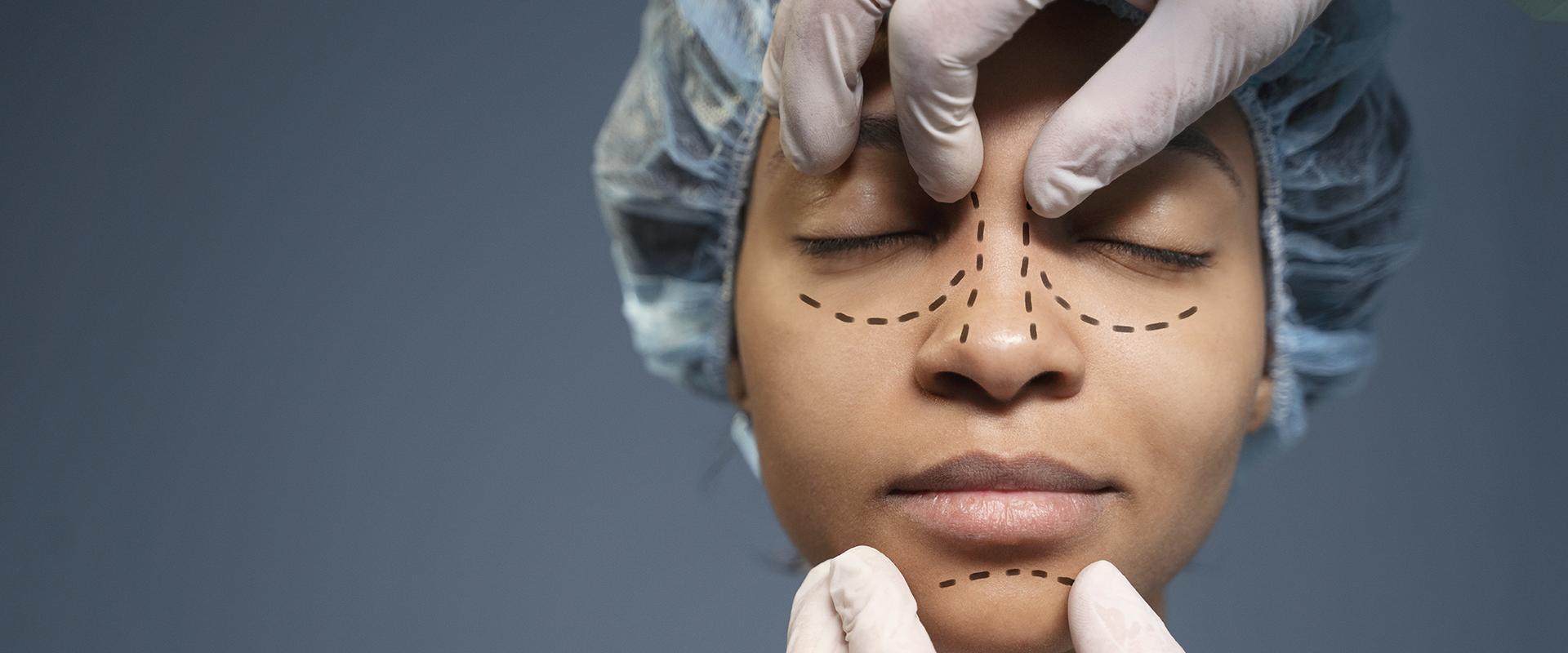 Scar Revision 